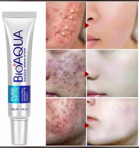 Gel Anti-Taches BioAqua